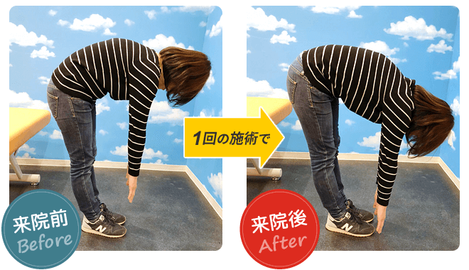 施術結果02